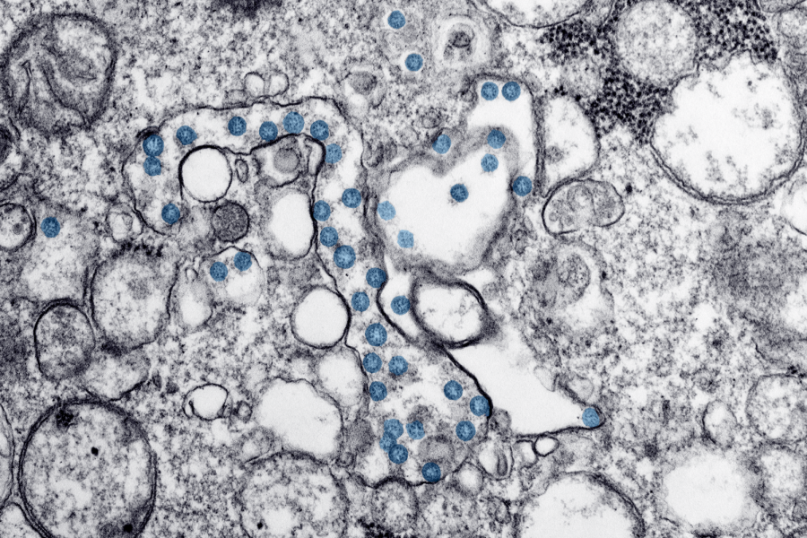 The coronavirus, pictured here in its microscopic form as an isolate from the first U.S. case, is causing fear throughout the world. How much should we prepare?